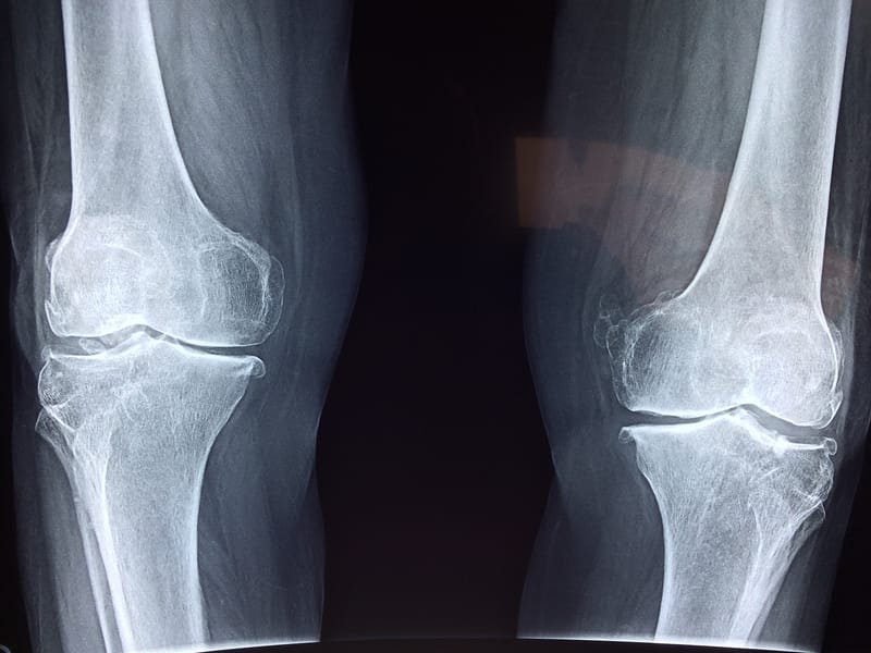 השתלמות טיפולי סו-ג'וק בבעיות מפרקי הגפיים