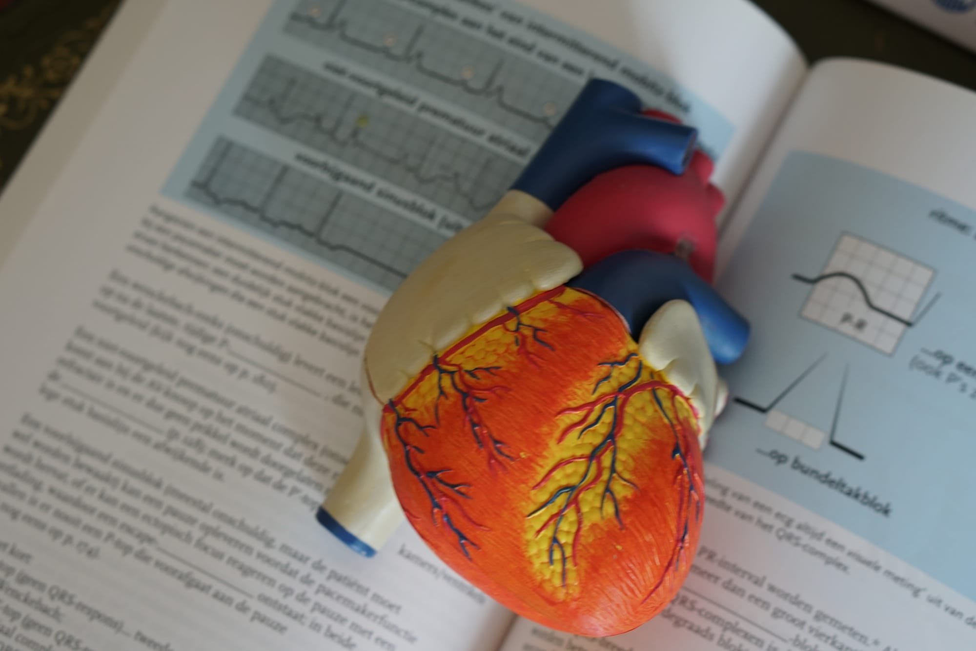 Mengenal Intervensi Kardiologi Untuk Atasi Permasalahan Jantung