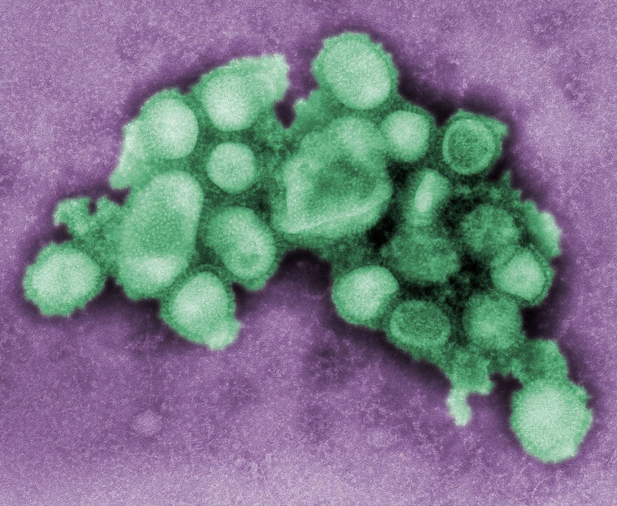 New England Journal of Medicine: Coronavirus Could Be No Worse than Flu.