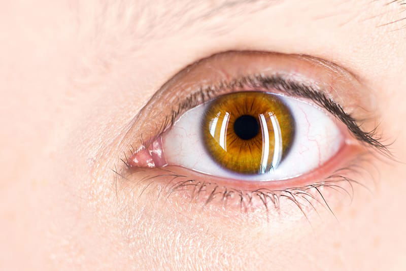 Problemas del ojo (resequedad, glaucoma, etc.)