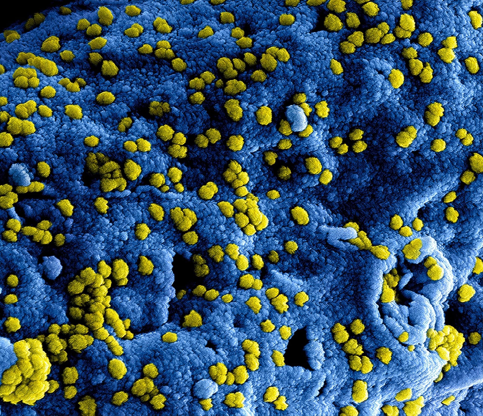 هل المناعة ضد الفيروسات تعتمد على وجود الاجسام المضادة فقط؟للدكتور عروة محمد هاني الملي/المانيا