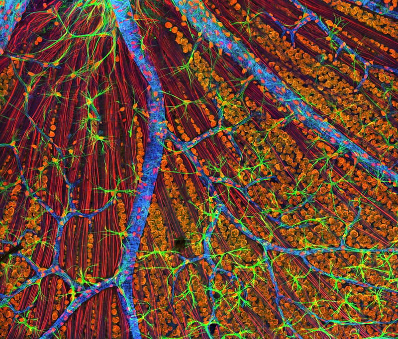 Retina and Glaucoma follow-up