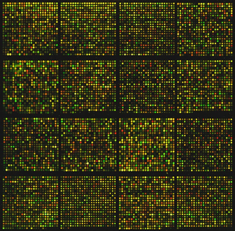 Revolutionary Gene-Editing Treatment as a Potential Replacement for Cholesterol Drugs