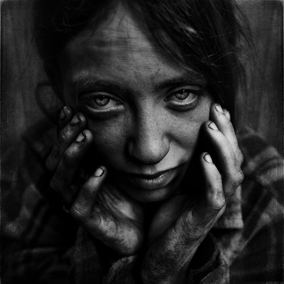 Lee Jeffries - Michelle, homeless, Leicester Sq. London