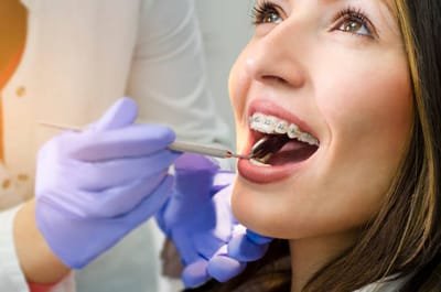 A Guide to Hiring an Orthodontist in Fort Worth  image