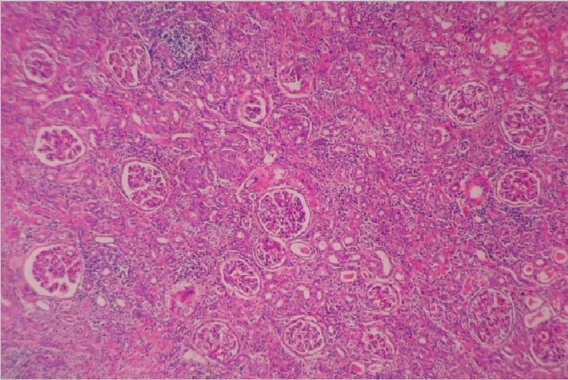 Kidney microscopic images (Glomeruli)