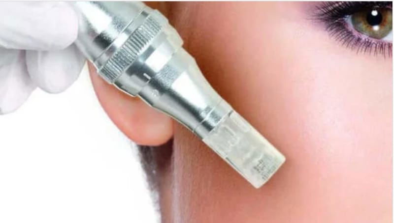 MICRONEEDLING