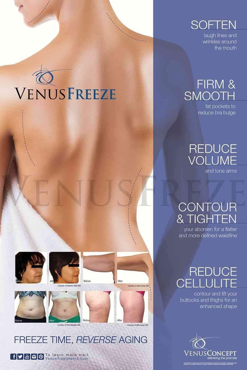 Venus Freeze Plus