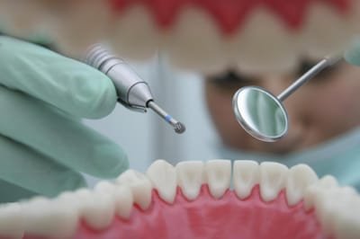 Dentistry-Choosing the Best Dentist image