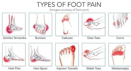 Feet pains guild post to help - Abingdon Footcare Practice