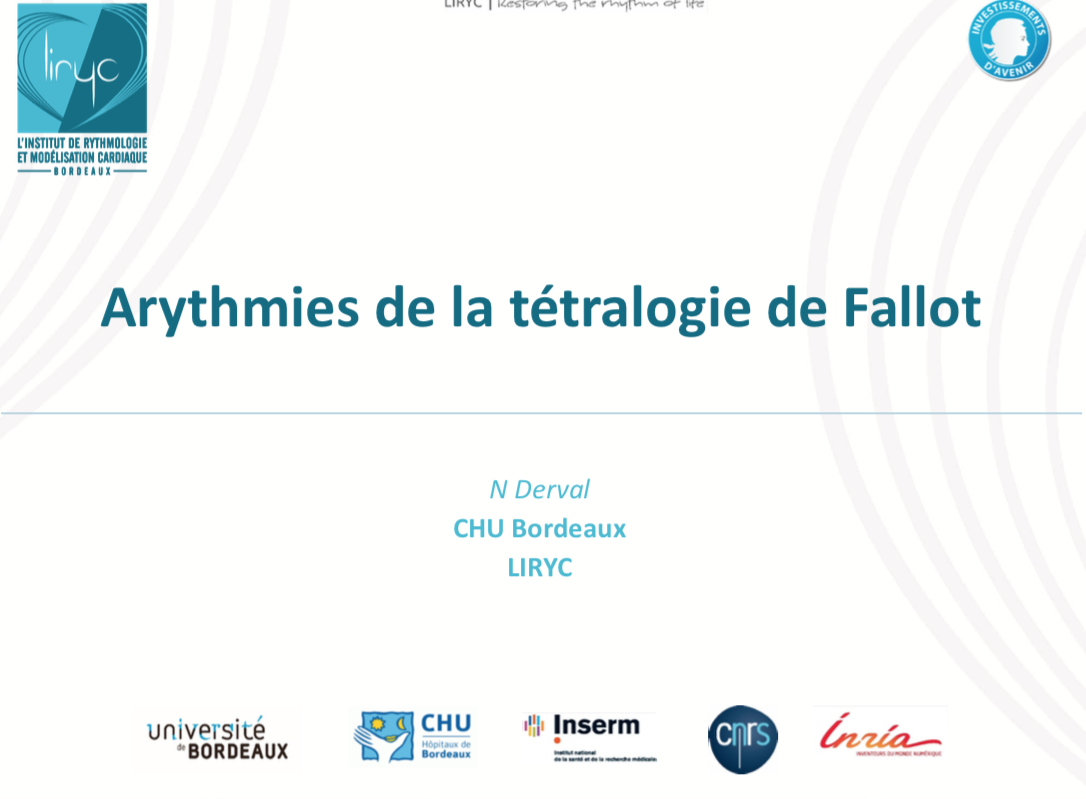 Arythmies de la Tétralogie de Fallot