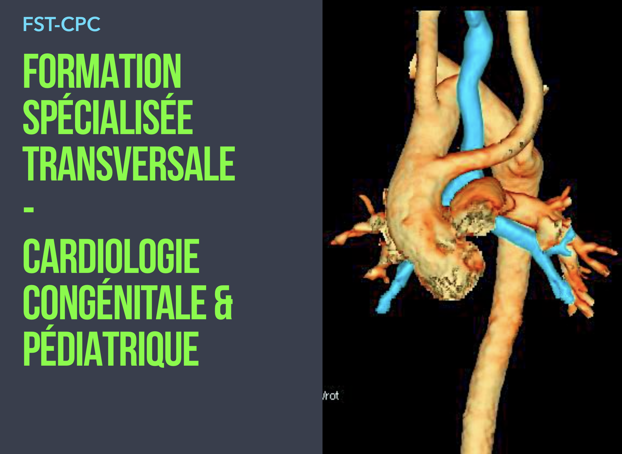 FST-CPC
