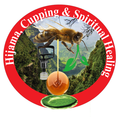 Hijama Cupping & Spiritual Healing.