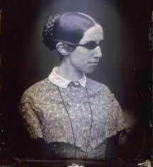 The woman who inspired Helen Keller's mother: Laura Bridgman