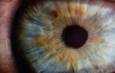 מחקר אירידיולוגיה  וצילום איריס של העין image