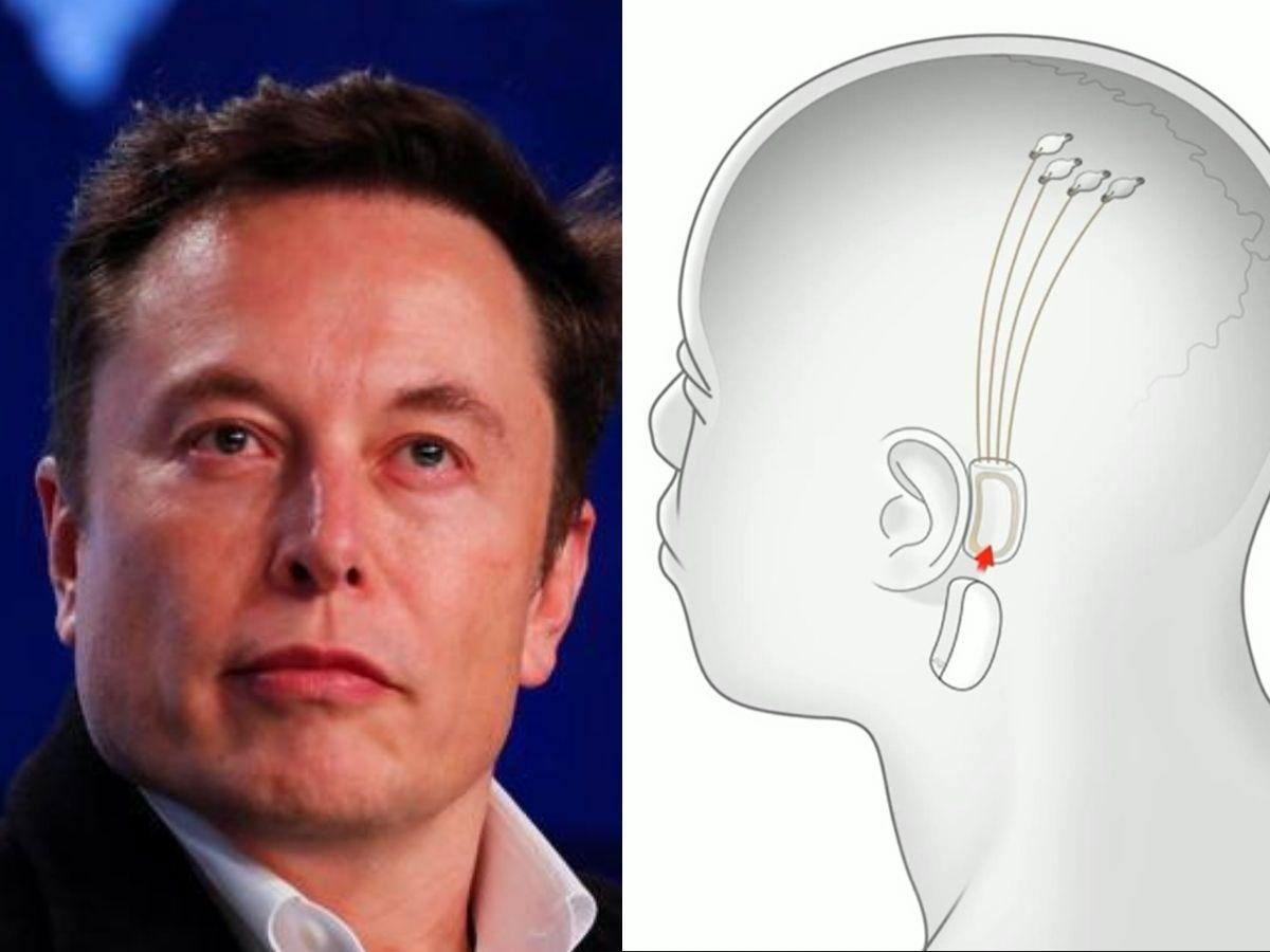 Will Elon Musk implant chips in humans in 2024 ?