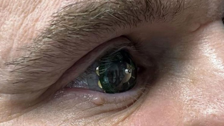 First-ever trials of smart contact lenses with augmented reality displays
