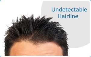 We provide undetectabe hair lines