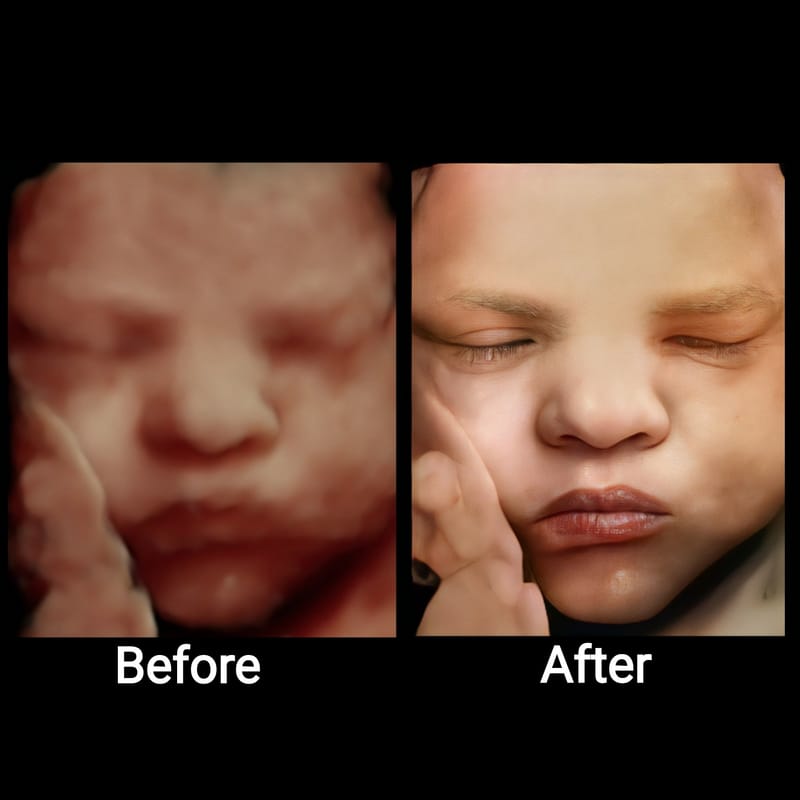 HD to Hd RealView (click for details)