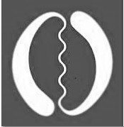 מהי קרמינולוגיה קלינית