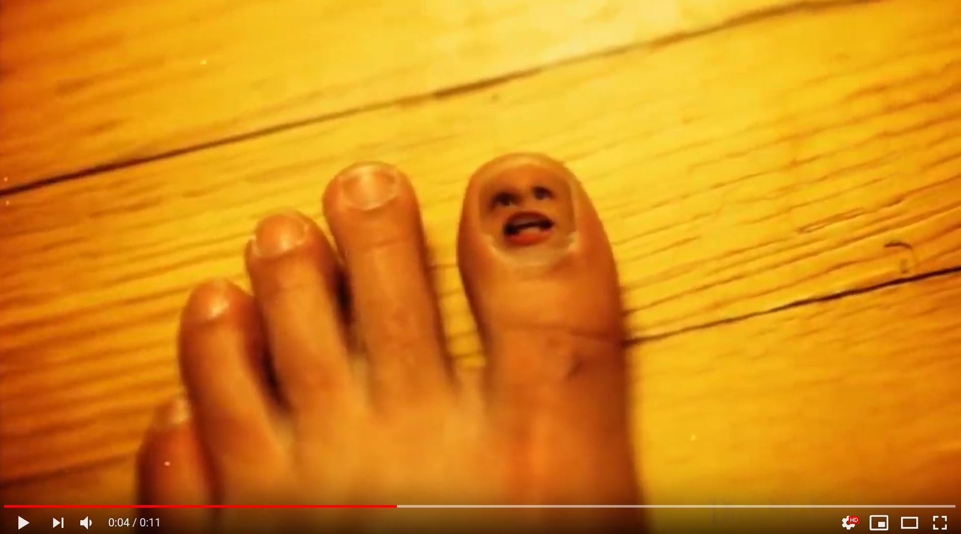 My living toe