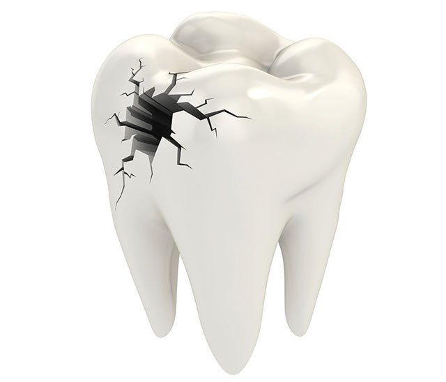 Лечение заболеваний зубов: