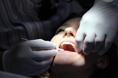 What You Need to Look At When Searching For a Reliable Dentist image