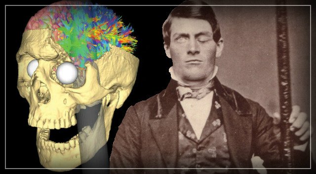 La véritable histoire de Phineas Gage, le patient le plus célèbre des neurosciences
