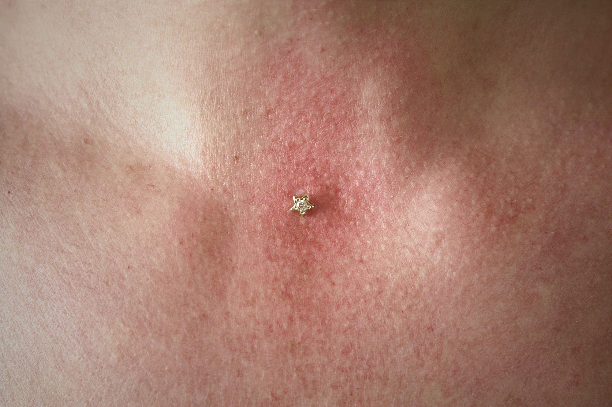 Microdermal Aqxas Paris