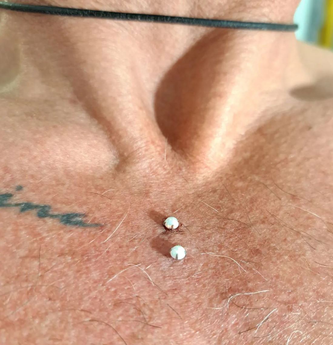 Surface chest opalines