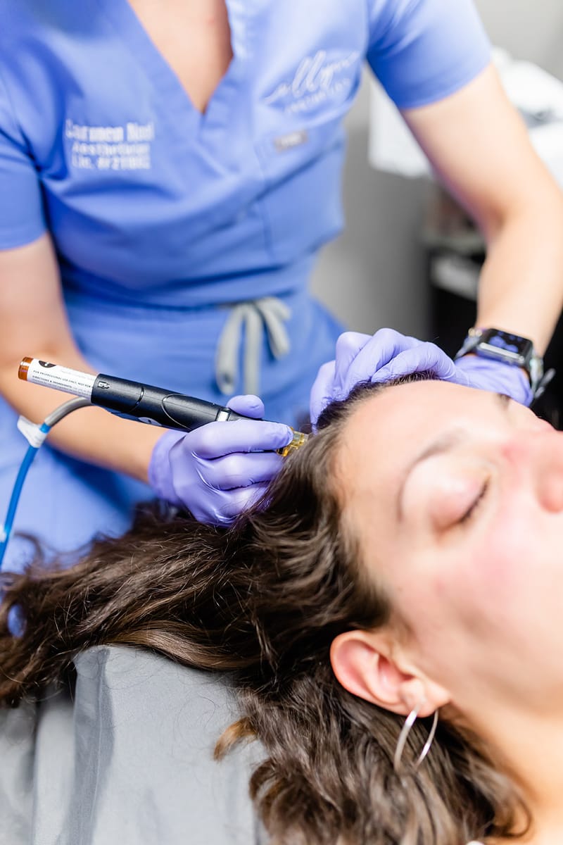 Hydrafacial Keravive scalp treatment Allyn Aesthetics