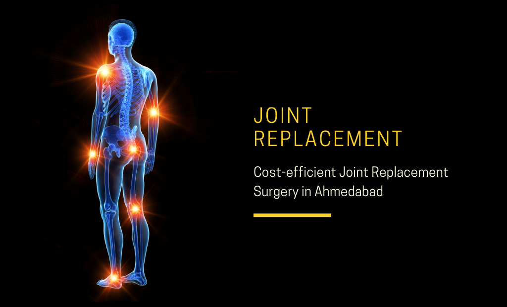 Cost-efficient Joint Replacement Surgery in Ahmedabad