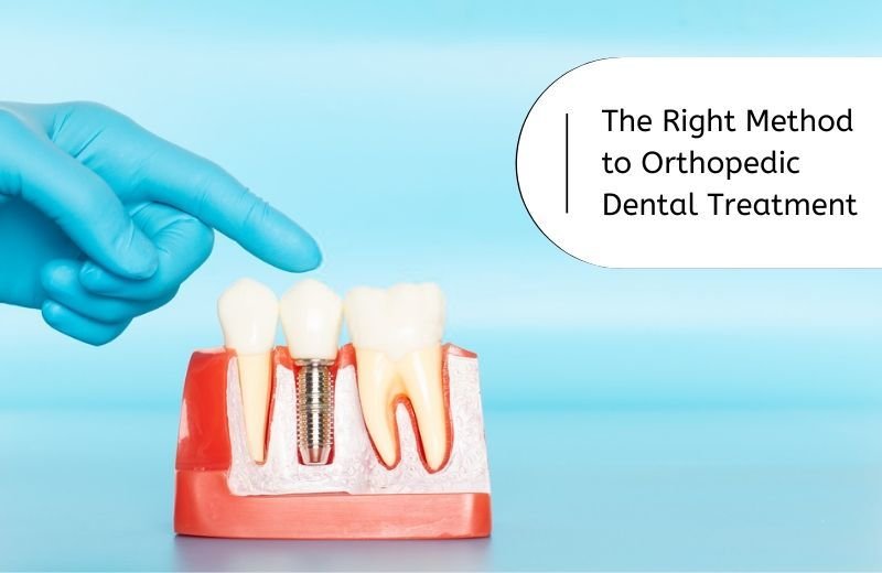 The right method to orthopedic dental treatment