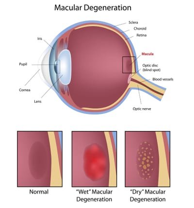Medical Retina  image