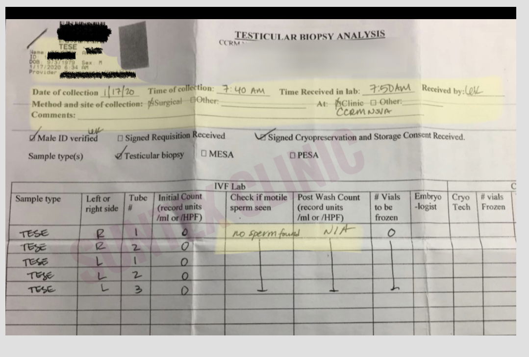 Mr A …. ( azoospermia / sertoli cell only syndrome)