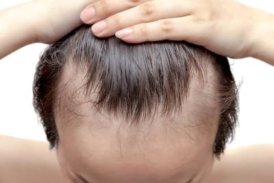 Benefits of Hair Restoration image