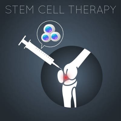 What You Need To Consider When You Are Choosing the Right Stem Cell Clinic image
