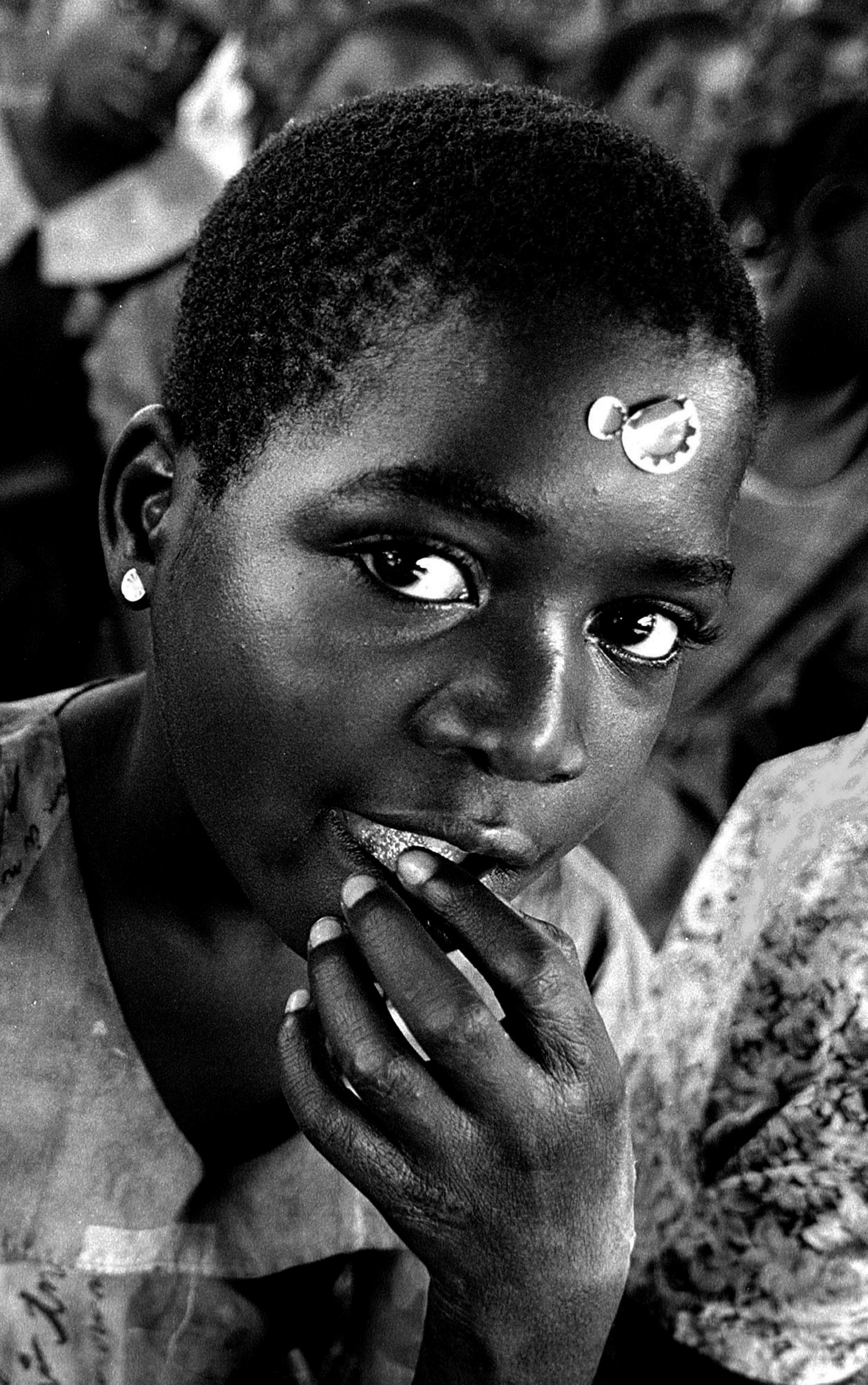 AIDS and Hunger  - Malawi