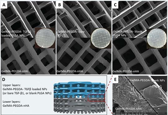 3D Printed Osteochondral Scaffold With Biomimetic Structure