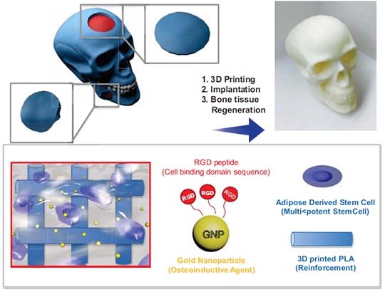 Bone tissue regeneration using 3D printed microstructure incorporated with hybrid nano hydrogel