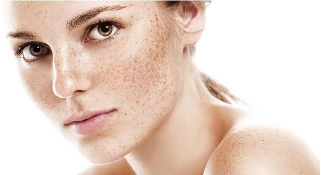 How to treat pigmentation ?