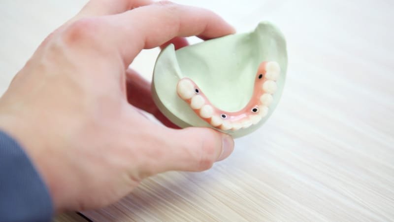 Implant Restorative Dentistry