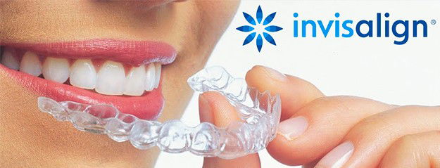 Coquilles invisibles Invisalign