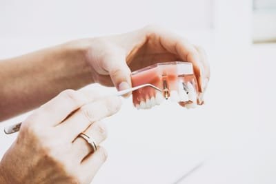 Pinpointing The Best Dental Implant Surgeon image