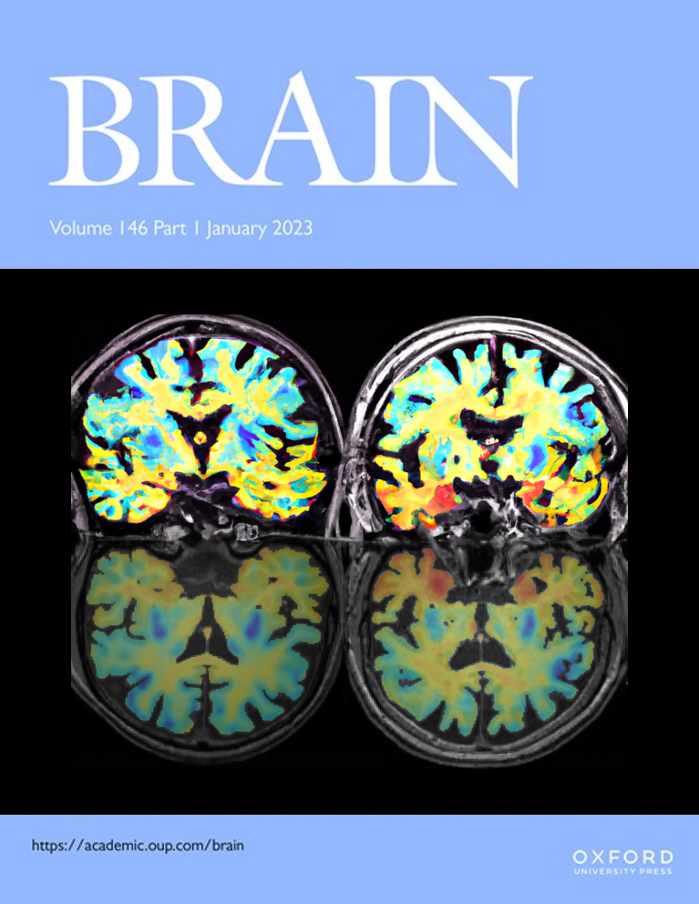 Our manuscript about Alzheimer's disease has just been published by BRAIN!