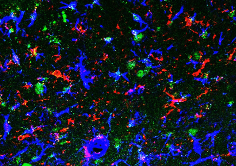 Astrocytes in the healthy brain