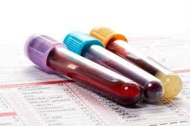 Quali sono gli esami di laboratorio utili per la diagnosi di emofilia?  image