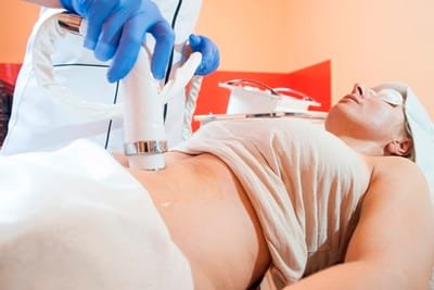 Why You Should Think of CoolSculpting image