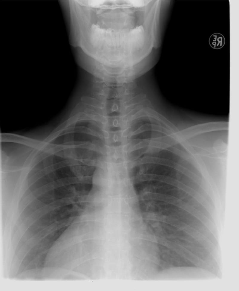 X-Ray Scanning