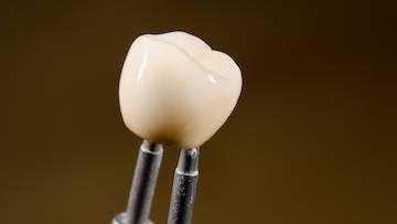 GETTING A DENTAL CROWN? HERE'S WHAT YOU'LL EXPECT FROM YOUR VISIT